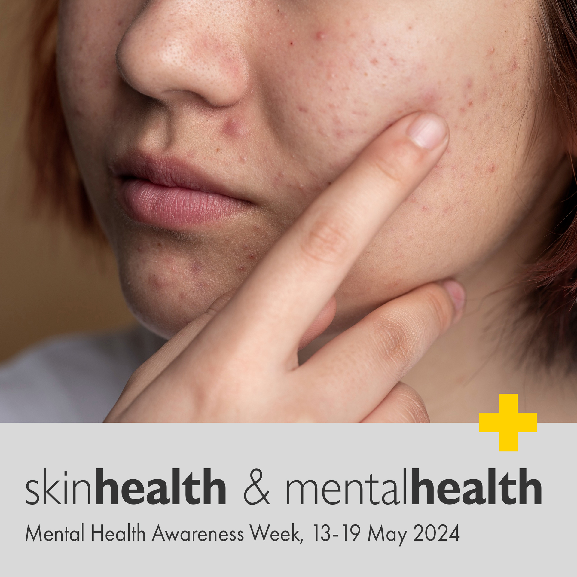 20240515_skinhealth&mentalhealth